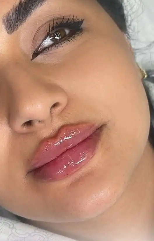 کلینیک زیبایی لیلاک