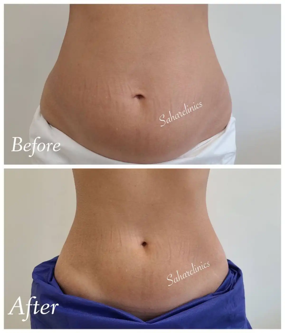 کلینیک تخصصی پوست و کاشت مو سحر