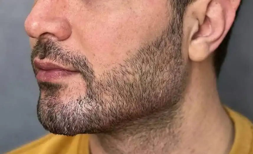 کلینیک زیبایی لیلاک