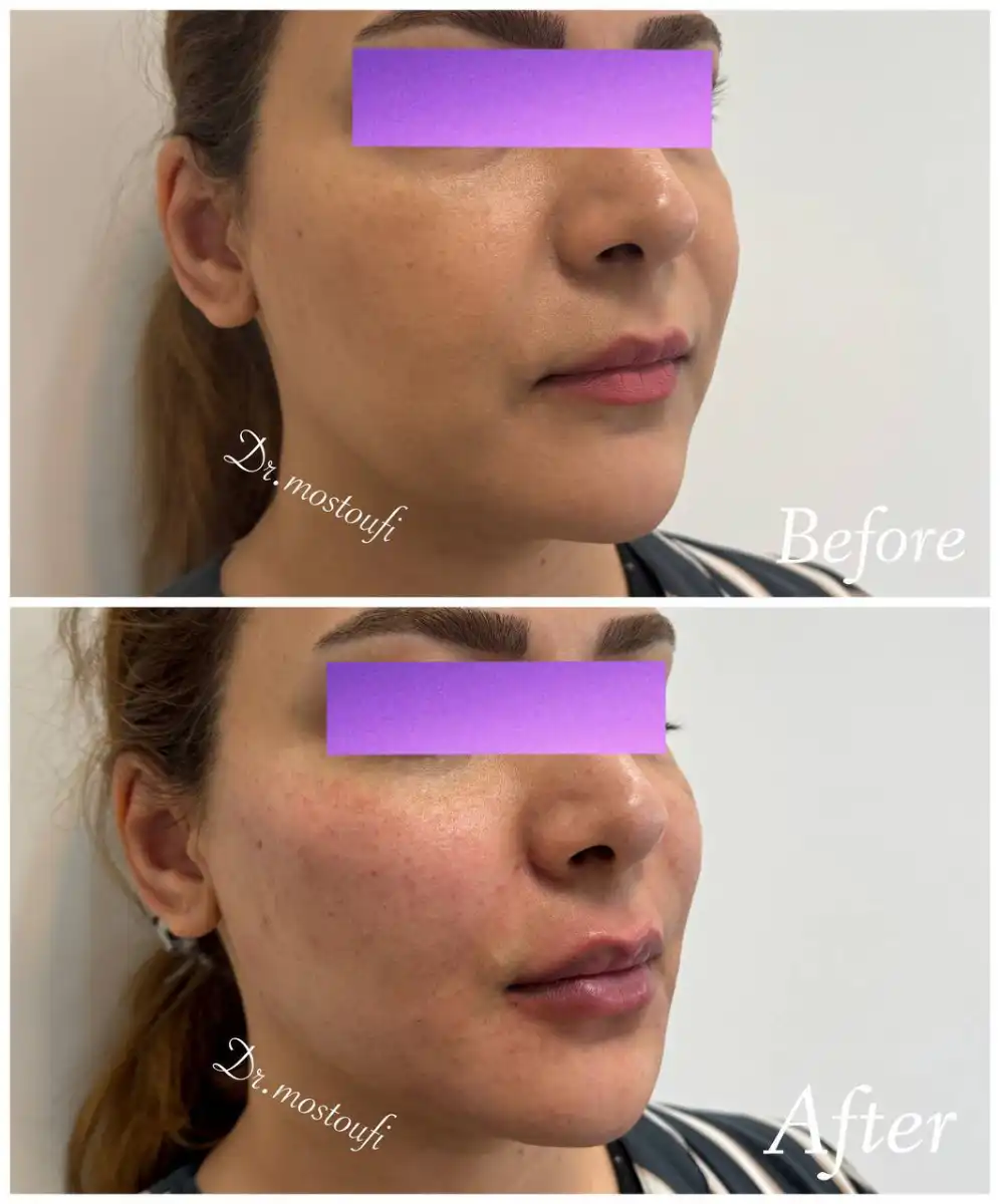 کلینیک تخصصی پوست و کاشت مو سحر