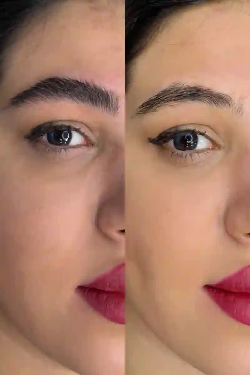 میکروبلیدینگ و شیدینگ مینا حسینی