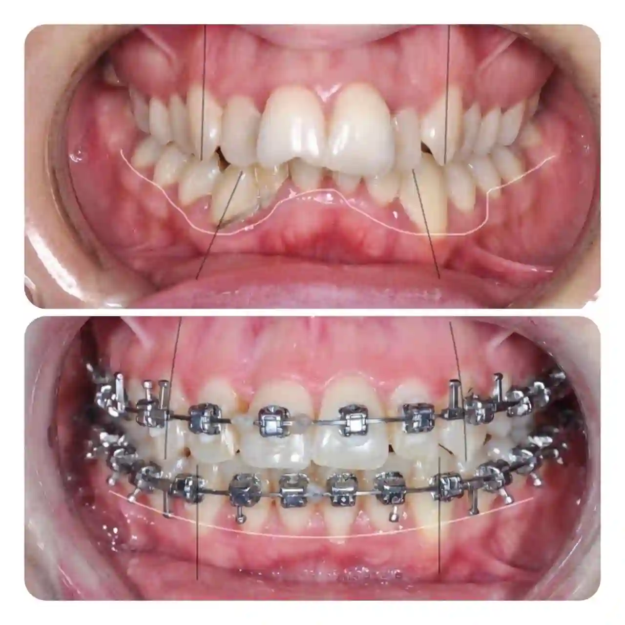 متخصص ارتودنسی دکتر نگاه بازقلعه