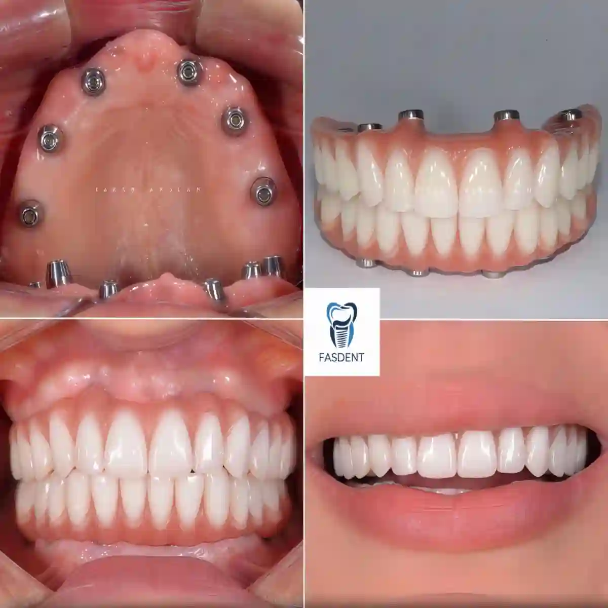 کلینیک فسدنت-دکتر کیوان علی پسندی