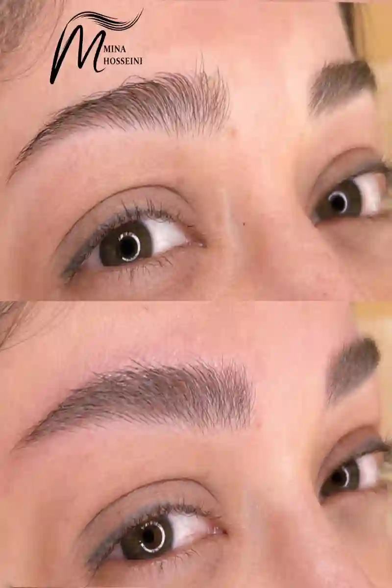 میکروبلیدینگ و شیدینگ مینا حسینی