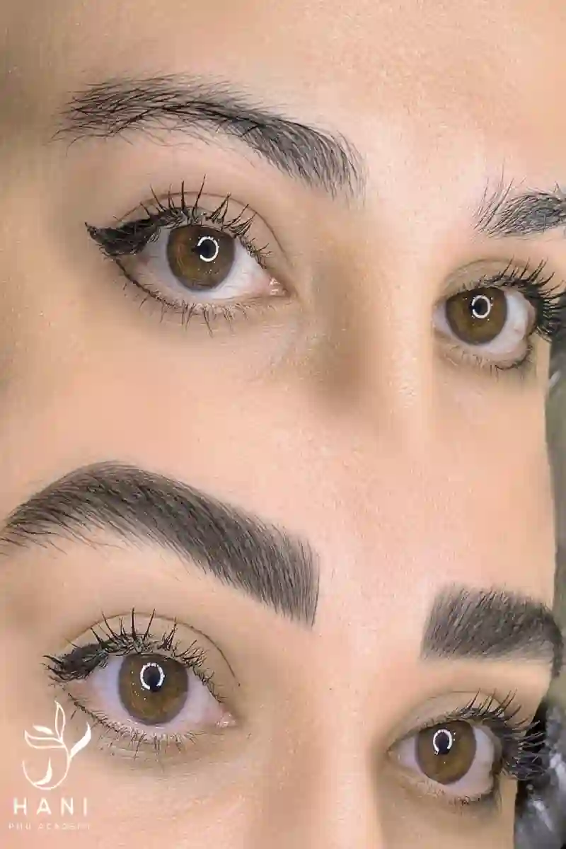 مرکز فوق تخصصی میکروبلیدینگ هانی